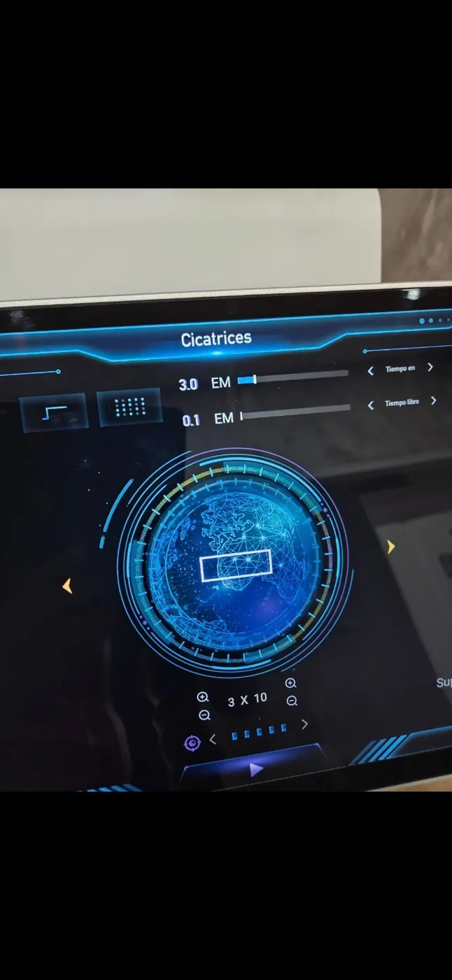Pantalla real del 800 Fractional CO₂ en el modo Cicatrices